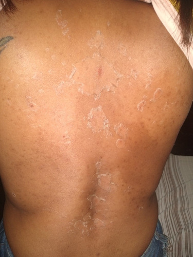 Imagen 3 de 4 de Crema Blanqueadora Para Todo Tipo De Cutis