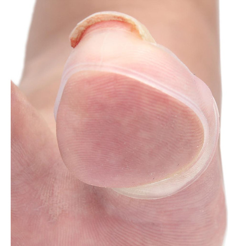 Corrección De Uñas Encarnadas Del Del Pie Cuidado De Los