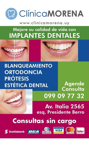 Imagen 1 de 1 de Implantes Dentales. Tarjetas!!!    18 Cuotas Con Scotiabank 