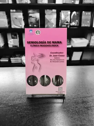 Semiología De Mama, Juan Cossa. Fefmur