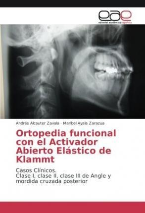Ortopedia Funcional Con El Activador Abierto Elastico De ...