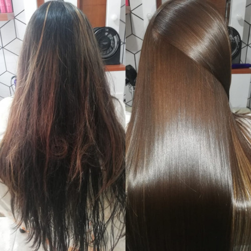Cirugia Capilar Celulas Madres Litro K - L a $44000