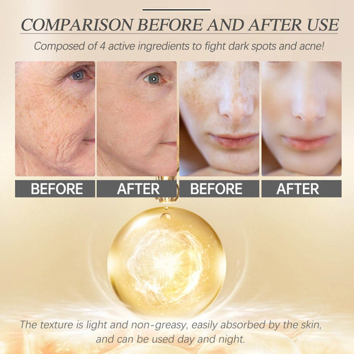 Crema Hidratante Facial Con Retinol D, Colágeno, Reduce La L