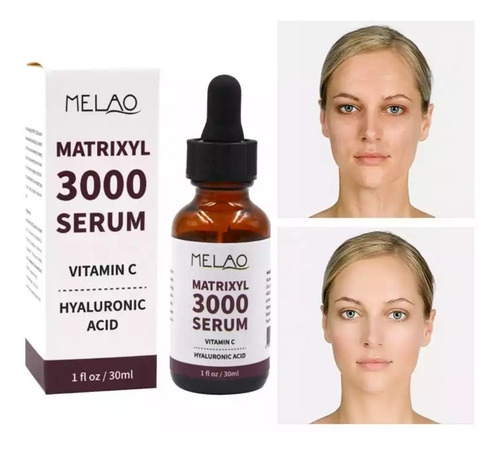 Sérum Matrixyl 3000 Vitamina C Y Ácido Hialurónico Colágeno