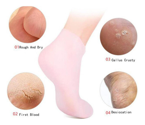 3 Calcetines De Silicona Suave Para Los Pies, Protección