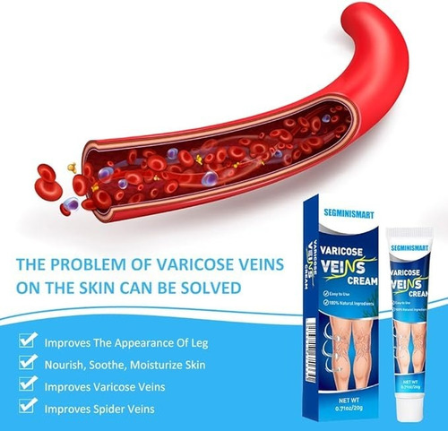 Crema Para Venas Varicosas