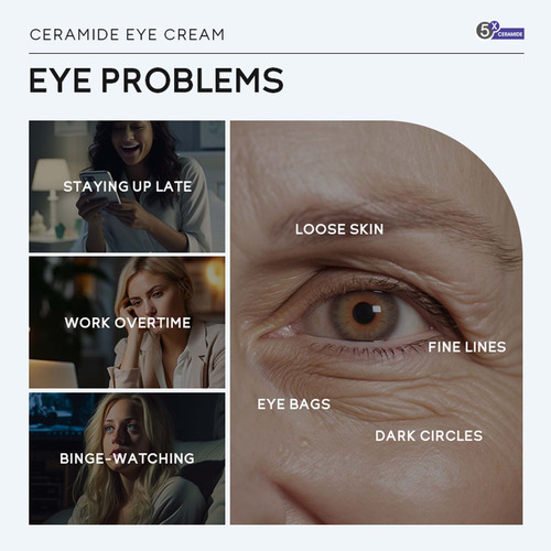 Lifting Eye Melhora A Elasticidade E Hidratação Da Pele 15g