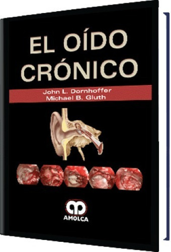 El Oído Crónico, De Dornhoffer. Editorial Amolca, Tapa Dura En Español, 2018