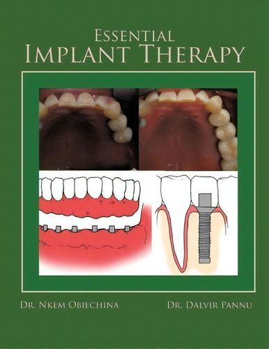 Essential Implant Therapy, De Dr. Nkem Obiechina. Editorial Authorhouse, Tapa Blanda En Inglés