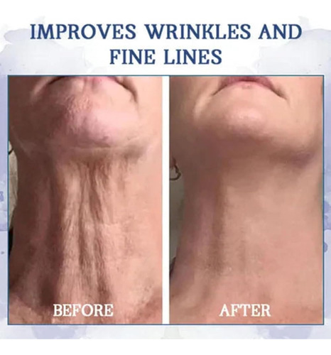 Fubsta Advanced Firming & Wrinkle-reducing Cream, Fubsta