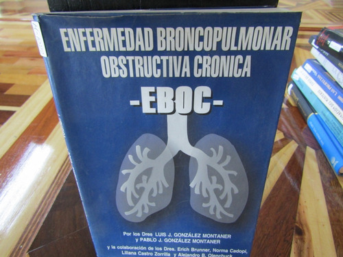 Enfermedad Broncopulmonar Obstructiva Cronica. Eboc. M-1022