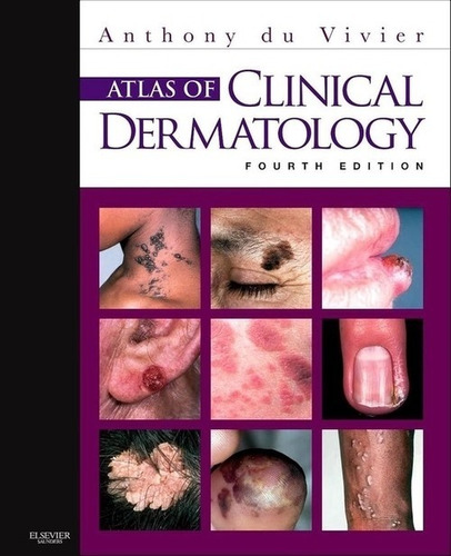 Libro Atlas Of Clinical Dermatology - Du Vivier, Anthony