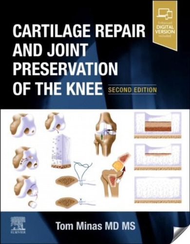Cartilage Repais And Joint Preservation Of The Knee