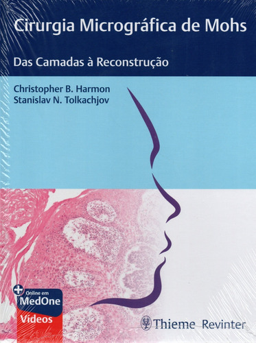 Cirurgia Micrográfica De Mohs