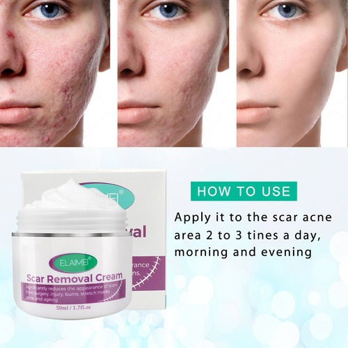 Creme De Remoção De Cicatriz De Alívio De Estrias 3pcs