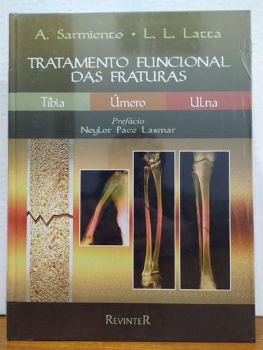 Um Tratamento Funcional Das Fraturas. Tibiaero E Ulna