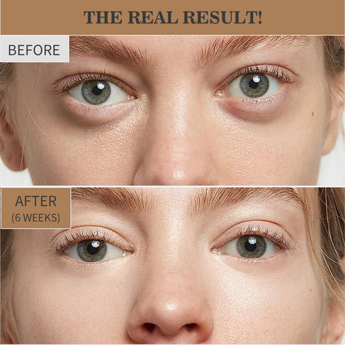 Creme Para Os Olhos Retinol Light Lines Fade Eye Creme Hidra