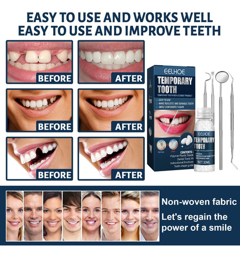 Kit De Reparación De Dientes, Juego De Dientes Temporales