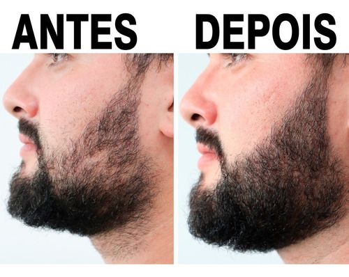 Imagem 7 de 9 de Escurecedor De Barba Preeche E Cobre Falhas + Shampoo