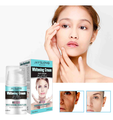 Crema Facial V Skin Care Hidratante, Iluminadora Y Shr 2002