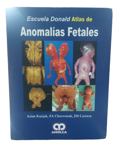 Atlas De Anomalías Fetales