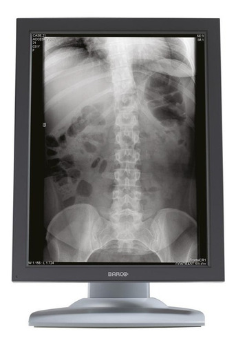 Monitor De Grado Medico Nio (e-3620 Ma) 3mp Barco