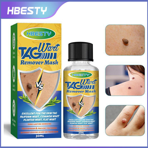 N Skin Tag, Agua Para Eliminar Lunares Y Verrugas