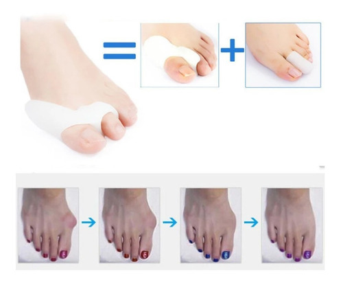 Imagen 6 de 10 de Separador Dedo Gordo Hallux Silica Gel Alivia Juanetes