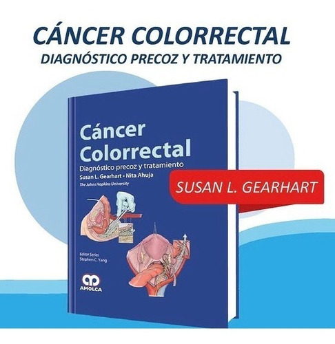 Cancer Colorrectal Diagnóstico Precoz Y Tratamiento