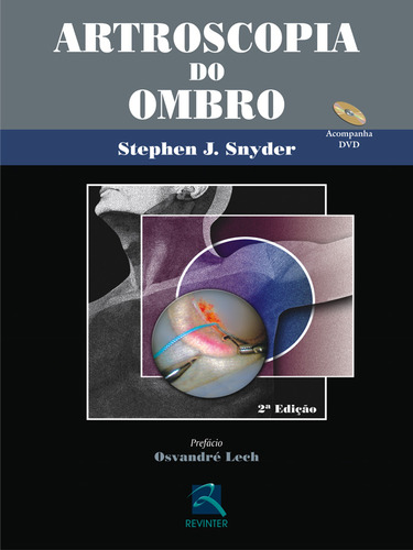 Artroscopia Do Ombro, De Null. Editora Revinter, Capa Dura Em Português, 5