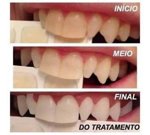 Pó Dental Clareador Com Carvão Ativado Hálito Fresco 30g