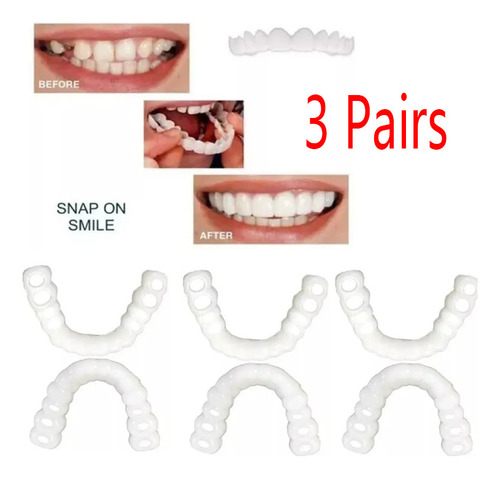 Aparatos De Prótesis Dentales Temporales, 3 Unidades