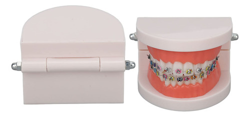Modelo De Dientes De Ortodoncia Con Soportes De Metal De