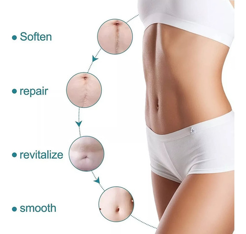Faixa Fita De Gel Abdominoplastia Cicatriz Queloide