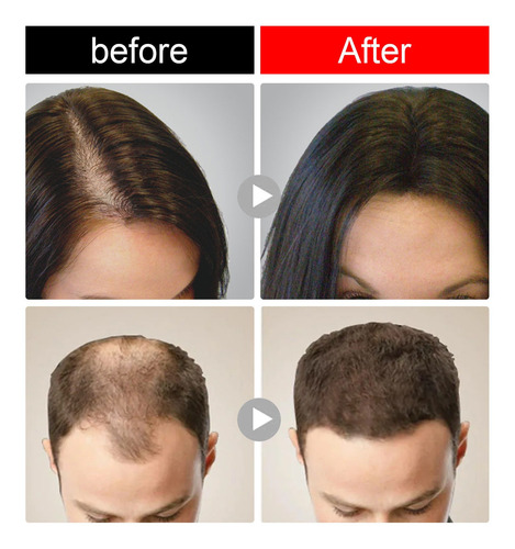2 Peças De Shampoo De Arroz, Sabonete, Essência De Arroz, Hi