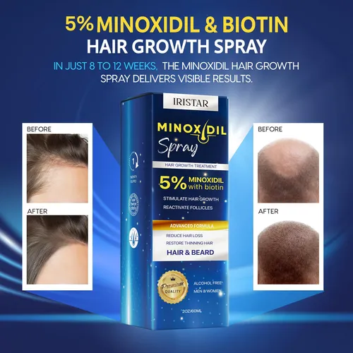 Spray Para El Crecimiento Del Cabello Iristar Minoxidil 5% P