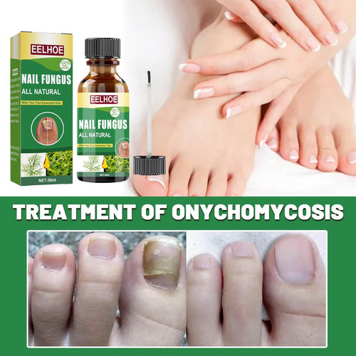 - Solución Contaminante Para El Cuidado De Las Uñas, 30 Ml