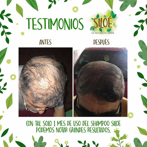 Pack De 3 Shampoos Siloe Contra Calvicie, Caspa, Alopecia.