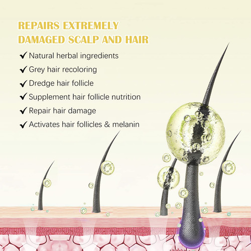 Sérum Para El Crecimiento Del Cabello Flasture Con 5% De Min