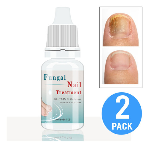 Suero Eficaz Para Hongos En Uñas - Pies Y Manos 2und