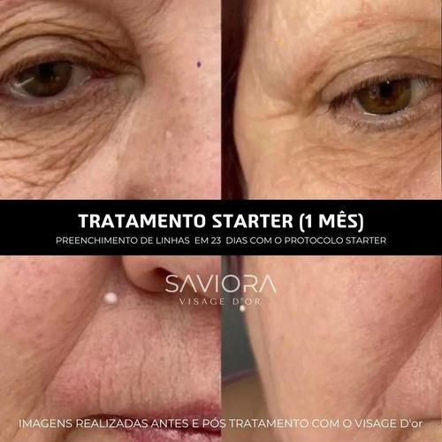 Visage Dor Sérum Clareador E Rejuvenescedor - Entrega Rápida Todo Tipo De Pele Noite