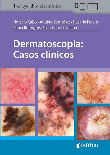 Libro - Dermatoscopia Casos Clinicos