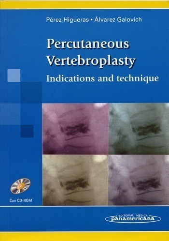 Percutaneous Vertebroplasty (vertebroplastia Percutanea)