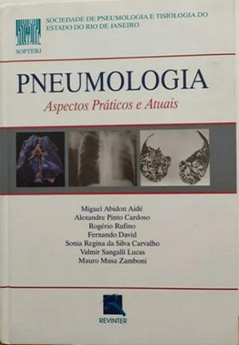 Pneumologia - Aspectos Práticos E Atuais - Sopterj, De Sopterj. Editora Revinter