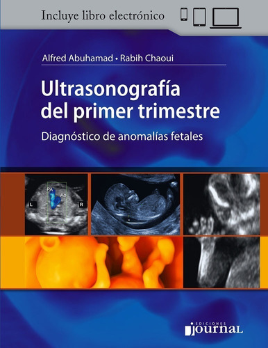 Abuhamad Chaoui Anomalías Fetales Ultrasonografía 1er Trimes