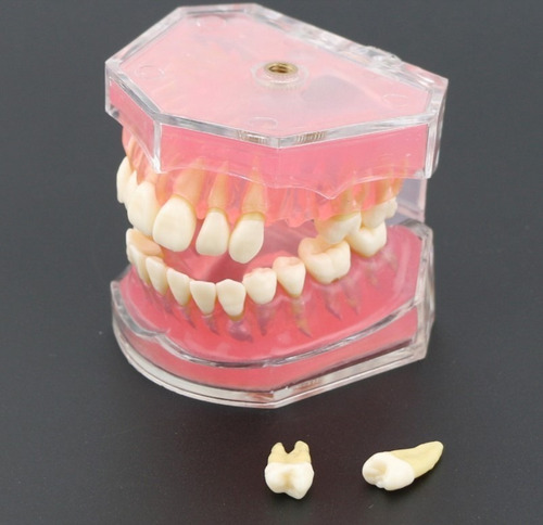 Imagen 3 de 10 de Modelo Acrílico Único Dientes Desmontables Encía Enseñanza
