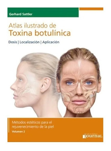 Atlas Ilustrado De Toxina Botulinica