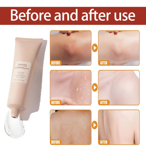 An Limpiador Facial Exfoliante Suave Para Todo Tipo De Piel.