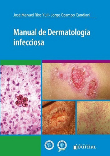 Manual Dermatologia Infecciosa Jose Manuel Rios Journal