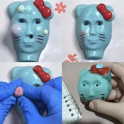 Juguete De Popper Gracioso Pimple, Estiramiento Inquieto